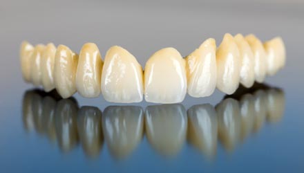 Zahnersatz (Prothetik) – Qualitativ hoch­wertige Zahn­ersatz­lösungen, die neben Funk­tio­nalität und Bio­kompatibili­tät ein hohes Maß an Ästhetik aufweisen.